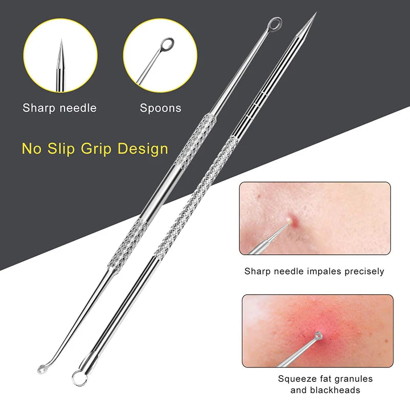 10 piece Blackhead Removal kit