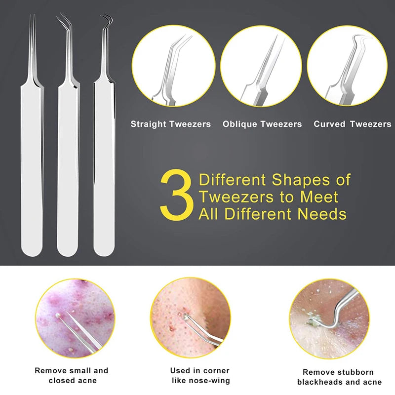 10 piece Blackhead Removal kit