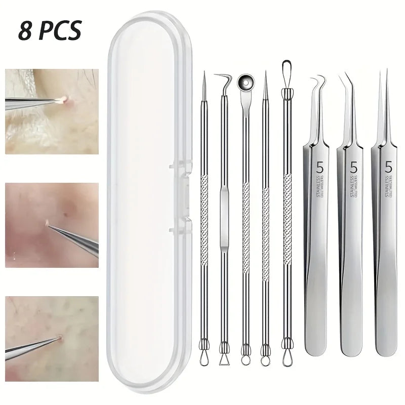 8-Piece Blackhead Remover Kit